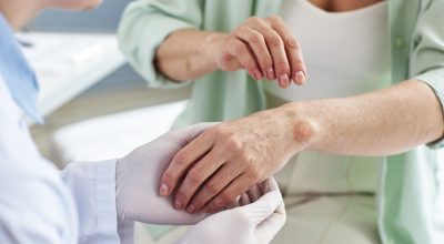 doctor-inspecting-skin-rash-on-hand-of-female-pati-2023-11-27-05-01-37-utc